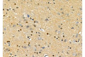 ABIN6257139 and ABIN6275758 at 1/100 staining Rat brain tissue by IHC-P. (DUSP10 Antikörper  (Internal Region))