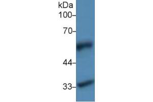 Western Blotting (WB) image for Fibulin 4 (FBLN4) ELISA Kit (ABIN6574323)