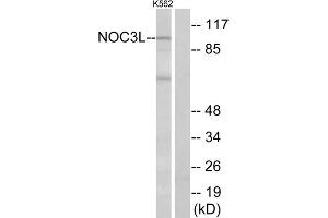 Western blot analysis of extracts from K562 cells, using NOC3L antibody. (NOC3L Antikörper  (Internal Region))