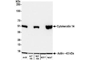Western Blotting (WB) image for anti-Keratin 14 (KRT14) (C-Term) antibody (ABIN7795698)