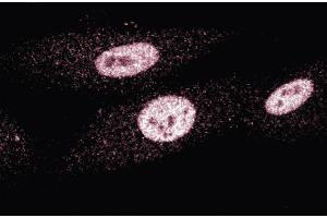 Immunofluorescence staining of human fibroblasts. (MSH3 Antikörper  (AA 136-349))