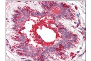 Immunohistochemistry (IHC) image for anti-Hepatocyte Growth Factor (Hepapoietin A, Scatter Factor) (HGF) antibody (ABIN492557) (HGF Antikörper)