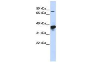 Image no. 1 for anti-LON Peptidase N-terminal Domain and Ring Finger 2 (LONRF2) (AA 576-625) antibody (ABIN6740829) (LONRF2 Antikörper  (AA 576-625))