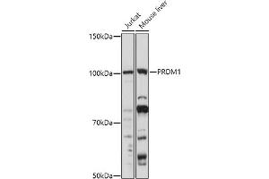 Western blot analysis of extracts of various cell lines, using (ABIN6128500, ABIN6146126, ABIN6146127 and ABIN6219111) at 1:1000 dilution. (PRDM1 Antikörper  (AA 1-240))