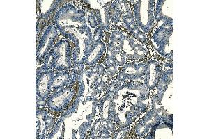 IHC analysis of F2R using anti-F2R antibody (ABIN7599952). (PAR1 Antikörper  (AA 130-425))