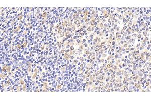 Detection of HSPA8 in Human Tonsil Tissue using Polyclonal Antibody to Heat Shock 70 kDa Protein 8 (HSPA8) (Hsc70 Antikörper  (AA 534-615))