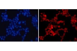 Immunofluorescence analysis of 293T cells using Asymmetric DiMethyl-Histone H4-R3 Polyclonal Antibody (Histone H4 Antikörper  (H4R3me2a))