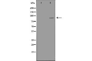 Western blot analysis of LoVo cell lysate, using PIBF1 Antibody. (PIBF1 Antikörper  (C-Term))