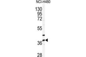 Western Blotting (WB) image for anti-Pantothenate Kinase 3 (PANK3) antibody (ABIN3003020) (PANK3 Antikörper)