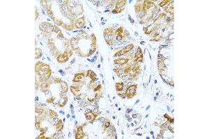 Immunohistochemistry of paraffin-embedded human stomach using INHBC antibody at dilution of 1:100 (40x lens).