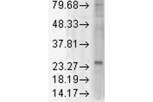 Western Blot analysis of Rat tissue lysate showing detection of KDEL Receptor protein using Mouse Anti-KDEL Receptor Monoclonal Antibody, Clone KR-10 . (KDELR Antikörper  (AA 192-212) (FITC))