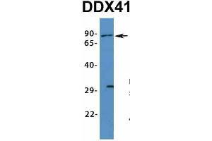 Host:  Rabbit  Target Name:  DDX41  Sample Type:  Human Fetal Muscle  Antibody Dilution:  1. (DDX41 Antikörper  (N-Term))