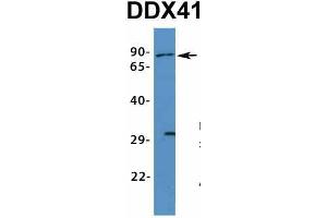 Host:  Rabbit  Target Name:  DDX41  Sample Type:  Human Fetal Muscle  Antibody Dilution:  1.