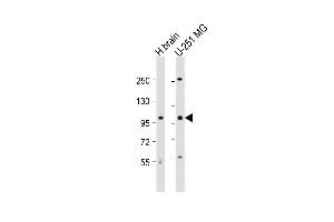 All lanes : Anti-MBD6 Antibody (C-term) at 1:1000 dilution Lane 1: human brain lysate Lane 2: U-251 MG whole cell lysate Lysates/proteins at 20 μg per lane. (MBD6 Antikörper  (C-Term))