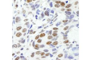 Immunohistochemistry (IHC) image for anti-Ewing Sarcoma Breakpoint Region 1 (EWSR1) (AA 100-150) antibody (ABIN7448557) (EWSR1 Antikörper  (AA 100-150))