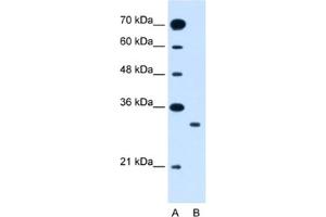 Western Blotting (WB) image for anti-Solute Carrier Family 25 (Mitochondrial Carrier: Glutamate), Member 22 (SLC25A22) antibody (ABIN2462766) (SLC25A22 Antikörper)