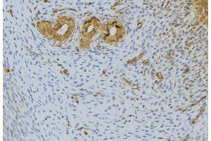 ABIN6276601 at 1/100 staining Human uterus tissue by IHC-P. (FGF10 Antikörper  (C-Term))