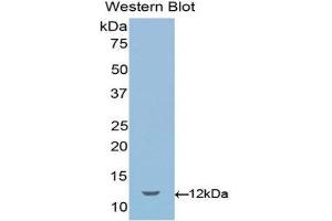 Western Blotting (WB) image for anti-Sema Domain, Immunoglobulin Domain (Ig), Short Basic Domain, Secreted, (Semaphorin) 3E (SEMA3E) (AA 581-669) antibody (ABIN1078523) (SEMA3E Antikörper  (AA 581-669))
