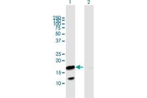 Western Blot analysis of VNN3 expression in transfected 293T cell line by VNN3 MaxPab polyclonal antibody. (VNN3 Antikörper  (AA 1-147))