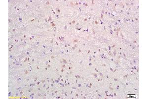 Formalin-fixed and paraffin embedded rat brain labeled with Anti-SRF/SAP2/MCM1 Polyclonal Antibody, Unconjugated (ABIN686017) at 1:200 followed by conjugation to the secondary antibody and DAB staining. (SRF Antikörper  (AA 101-250))