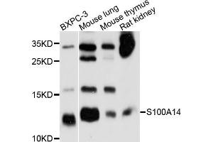 Western blot analysis of extracts of various cell lines, using S100A14 antibody (ABIN5998736) at 1/1000 dilution. (S100A14 Antikörper)