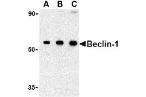 AP20054PU-N Beclin-1 antibody staining of 293 cell lysate by Western Blotting at (A) 0. (Beclin 1 Antikörper  (N-Term))