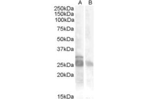 Image no. 1 for anti-Myogenic Factor 5 (MYF5) (Internal Region) antibody (ABIN374951) (MYF5 Antikörper  (Internal Region))