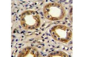 Immunohistochemistry (IHC) image for anti-Chemokine (C-X-C Motif) Receptor 3 (CXCR3) (AA 140-167) antibody (ABIN3030510)