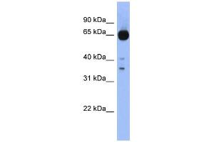 WB Suggested Anti-ZIC4 Antibody Titration:  0. (ZIC4 Antikörper  (Middle Region))