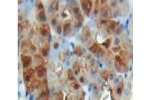 Used in DAB staining on fromalin fixed paraffin-embedded Kidney tissue (HIF1A Antikörper  (AA 575-826))