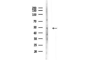 anti-Vacuolar Protein Sorting 36 (VPS36) (Internal Region) antibody