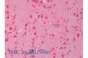 ABIN1590089 (5µg/ml) staining of paraffin embedded Human Cortex. (DVL1 Antikörper  (Internal Region))