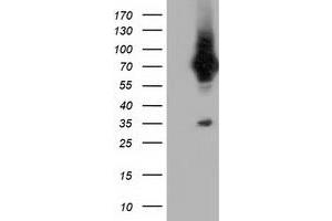 Western Blotting (WB) image for anti-Von Willebrand Factor A Domain Containing 5A (VWA5A) antibody (ABIN1501748) (VWA5A Antikörper)
