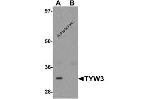 Western Blotting (WB) image for anti-tRNA-YW Synthesizing Protein 3 Homolog (TYW3) (Middle Region) antibody (ABIN1031152) (TYW3 Antikörper  (Middle Region))