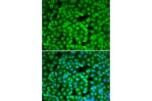 Immunofluorescence analysis of A549 cells using FBL antibody (ABIN6292110). (Fibrillarin Antikörper)