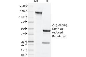 SDS-PAGE Analysis Purified CD134 Rat Monoclonal Antibody (OX-86).