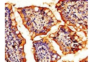 Immunohistochemistry of paraffin-embedded human small intestine tissue using ABIN7154893 at dilution of 1:100 (HSF2 Antikörper  (AA 79-173))