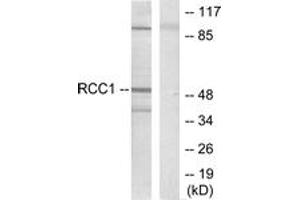 Western blot analysis of extracts from HepG2 cells, using Retinoic Acid Receptor beta Antibody. (Retinoic Acid Receptor beta Antikörper  (AA 331-380))