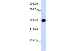 WB Suggested Anti-LIAS Antibody Titration:  0. (LIAS Antikörper  (N-Term))