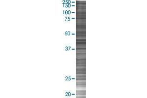 MEF2C transfected lysate. (MEF2C 293T Cell Transient Overexpression Lysate(Denatured))