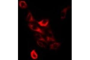 Immunofluorescent analysis of TC-PTP staining in Jurkat cells. (PTPN2 Antikörper)