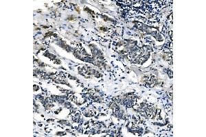 IHC analysis of PCK2 using anti-PCK2 antibody (ABIN7599509). (PEPCK Antikörper  (AA 1-640))
