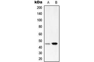 Western blot analysis of Serpin A1 expression in HepG2 (A), HeLa (B) whole cell lysates.