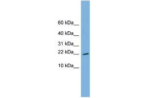 Human THP-1; WB Suggested Anti-RPS13 Antibody Titration: 0. (RPS13 Antikörper  (Middle Region))
