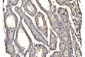 IHC analysis of Kinectin 1/KTN1 using anti-Kinectin 1/KTN1 antibody (ABIN7601096). (KTN1 Antikörper  (AA 283-827))