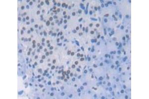 IHC-P analysis of Human Tissue, with DAB staining. (TRADD Antikörper  (AA 61-297))