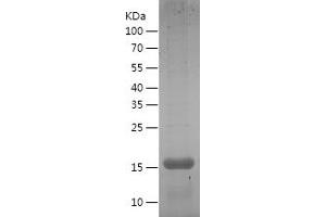Western Blotting (WB) image for Interleukin 1, beta (IL1B) (AA 116-268) protein (His tag) (ABIN7123532) (IL-1 beta Protein (AA 116-268) (His tag))