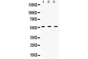Western blot analysis of TGFBR1 expression in rat cardiac muscle extract ( Lane 1), mouse liver extract ( Lane 2) and HELA whole cell lysates ( Lane 3). (TGFBR1 Antikörper  (N-Term))
