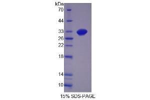 SDS-PAGE analysis of Mouse GDF11 Protein. (GDF11 Protein)