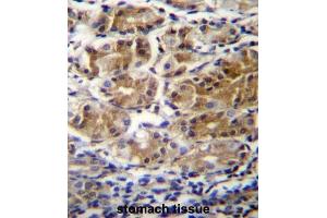 Immunohistochemistry (IHC) image for anti-Pyruvate Dehydrogenase Phosphatase Regulatory Subunit (PDPR) antibody (ABIN2996488) (PDPR Antikörper)